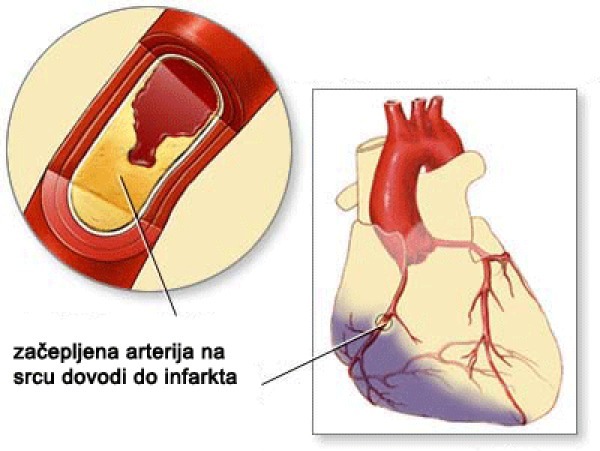 arterija